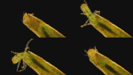 毛翅目幼虫的显微镜观察高清在线视频素材下载