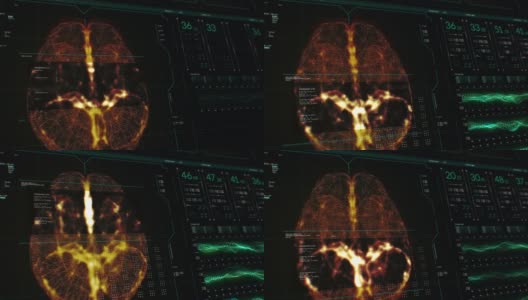 动画的用户界面HUD与大脑分析黑暗背景的网络未来概念与谷物处理高清在线视频素材下载