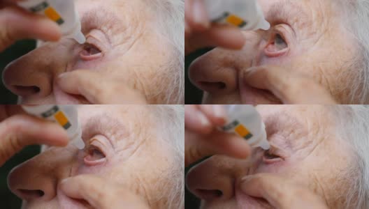 老妇人正在往眼睛里滴药。祖母的画像。医疗保健和医疗理念。特写慢动作高清在线视频素材下载