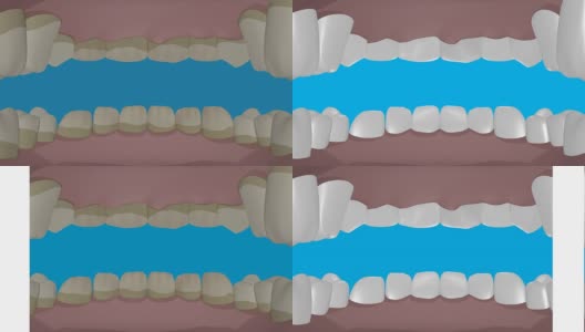 清洁牙齿高清在线视频素材下载