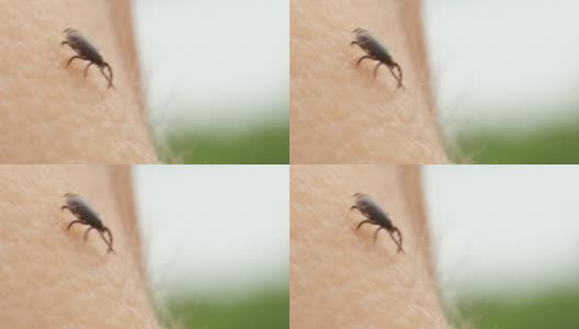 蜱虫在皮肤上行走-微距拍摄高清在线视频素材下载