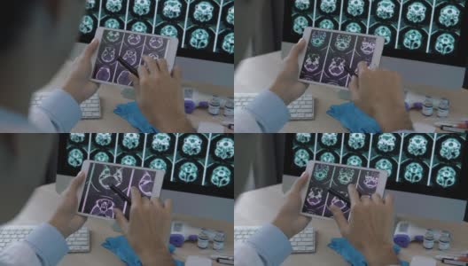 医生用数码平板电脑对病人进行脑部扫描分析高清在线视频素材下载