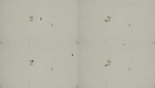 毛滴虫在显微镜下处于分裂和接合阶段高清在线视频素材下载