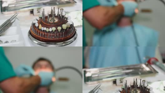 修补病人的牙齿高清在线视频素材下载