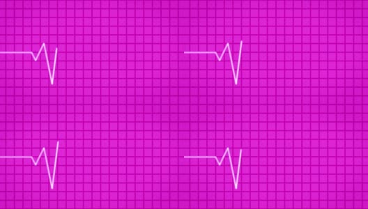 心电图(EKG或ECG)环粉红色高清在线视频素材下载