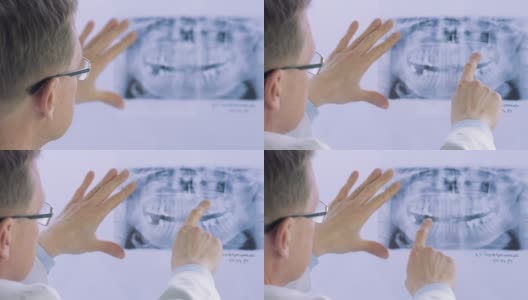 牙医看牙科x光板的特写高清在线视频素材下载