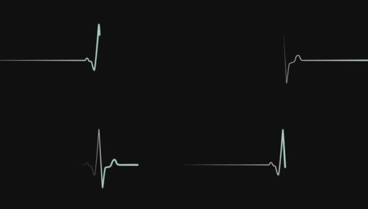 心电图或心电图显示为青色平线高清在线视频素材下载