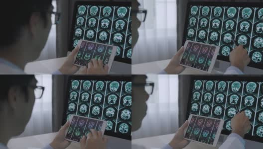医生用数码平板电脑对病人进行脑部扫描分析高清在线视频素材下载