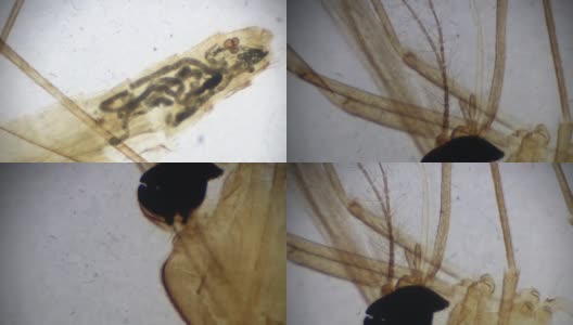 蚊子-显微镜下的雌性W.M.高清在线视频素材下载