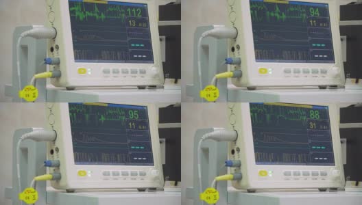手术室心脏监护仪高清在线视频素材下载