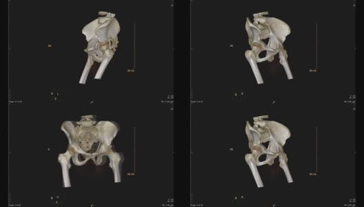 骨盆骨CT扫描。高清在线视频素材下载