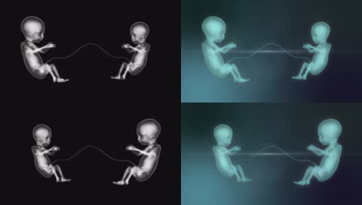 双胞胎小新生儿婴儿的X射线概念未来，3D动画。4 k高清在线视频素材下载