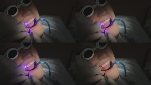 牙科医生临床用牙科治疗仪检查女性患者高清在线视频素材下载