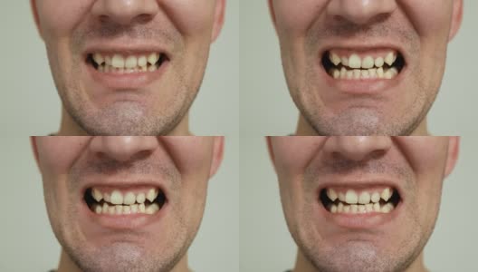 男人露出黄色、弯曲和磨损的牙齿高清在线视频素材下载