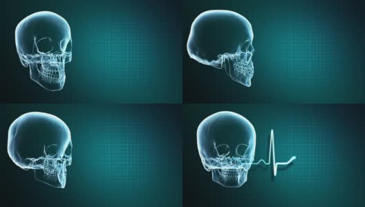 x射线头骨和心脏监视器高清在线视频素材下载