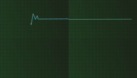 心电图高清在线视频素材下载