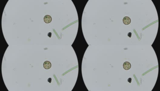 在显微镜下观察gibbosa阿赛拉变形虫的状态高清在线视频素材下载