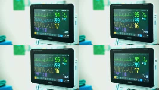 手术室4K心脏监护仪。心电监护仪显示患者的心率背景高清在线视频素材下载