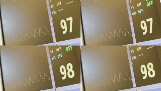 手术室和急诊室的心率监视器显示心跳高清在线视频素材下载