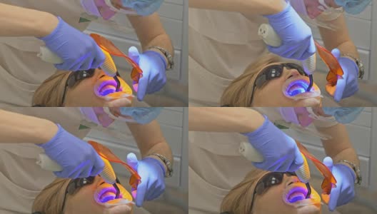 牙医在一间现代化的牙科诊所里为病人治疗。牙齿矫正医师有一个助手。病人用蓝色激光牙消毒。橙色的玻璃百叶窗用于保护眼睛。高清在线视频素材下载