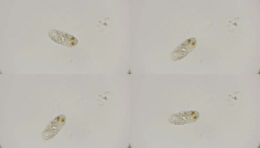 在显微镜下观察滴虫鞋高清在线视频素材下载