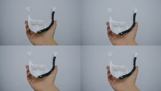 手握面部下颌骨内假体的金属3D打印机打印从生物ert钛合金近距离。颌面外科三维模型仿生植入物。下颌面部假体高清在线视频素材下载