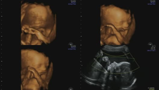 胎儿在母体子宫内摩擦鼻子和玩脐带-超声扫描妊娠3d和4d超声检查妊娠胎儿人类胚胎检查胎儿超声检查26周妊娠中期高清在线视频素材下载