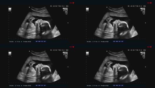超声波检查，胎儿在子宫里高清在线视频素材下载