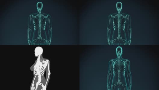 疼痛的椎骨的3d渲染图。医学概念动画。高清在线视频素材下载