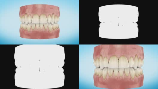 肮脏的黄色牙齿放大3d动画。阿尔法通道。高清在线视频素材下载