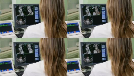 医疗保健的概念。医院医生正在看CT扫描。在肩膀上方拍摄的女性医学科学家与扫描图像上的个人电脑在实验室。神经学研究中心。高清高清在线视频素材下载