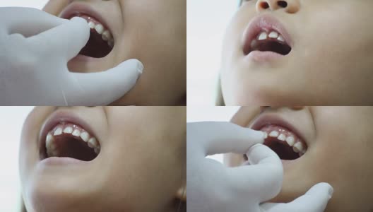 牙医检查小女孩的牙齿用手套摆动松动的牙齿高清在线视频素材下载