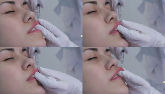 唇部注射整形手术高清在线视频素材下载