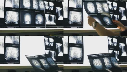 医生分析放射学高清在线视频素材下载