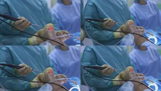 手术室内的特写镜头。医疗团队的成功协作高清在线视频素材下载