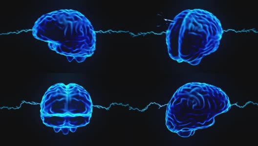 大脑全息图旋转火花闪电电流头痛神经元循环4k高清在线视频素材下载