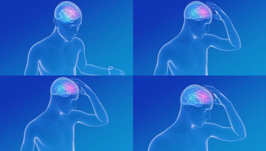 人体解剖三维动画显示头痛。癫痫、头痛。高清在线视频素材下载