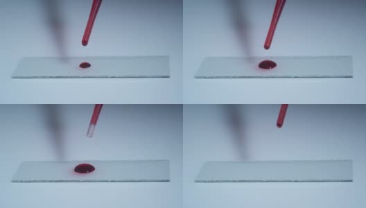 实验室的技术人员在医院检测血液样本，把手关上。开发冠状病毒测试。疾病高清在线视频素材下载