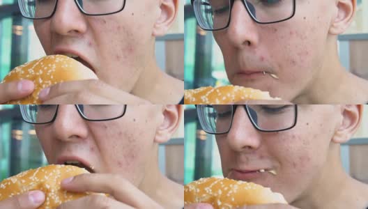 一个脸上长痘痘的年轻人在吃汉堡包。高清在线视频素材下载