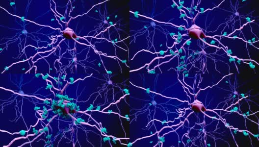 衰老大脑中的神经元或神经元中的蛋白质死亡高清在线视频素材下载