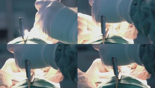 外科医生在鼻整形手术中缝合的特写高清在线视频素材下载