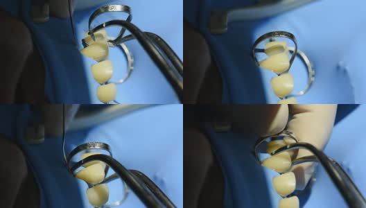 牙科柜中牙齿的近景。高清在线视频素材下载