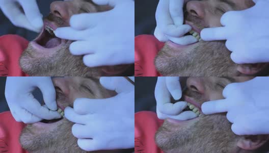 牙医-植牙高清在线视频素材下载