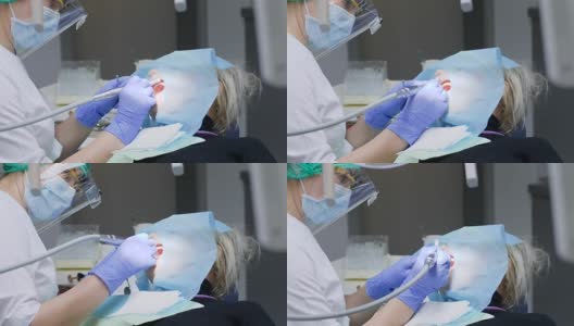 在现代医院，牙科医生戴着口罩和无菌手套，手持器械，治疗病人张口的牙齿高清在线视频素材下载