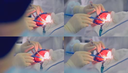 手戴手术手套，使用消毒设备进行手术。4 k。高清在线视频素材下载