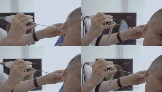 医生用耳鼻喉望远镜检查一个成年人的耳朵高清在线视频素材下载