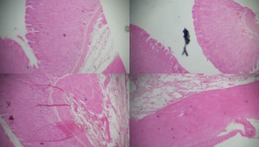 stomatch活检显微镜高清在线视频素材下载