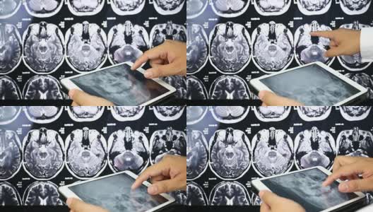 医生使用数字平板检查颅骨x射线扫描，医疗保健和医学概念高清在线视频素材下载