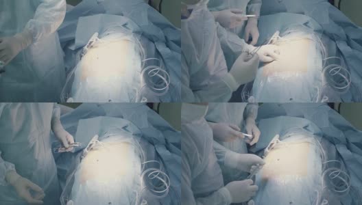 腹腔镜手术前的腹部高清在线视频素材下载