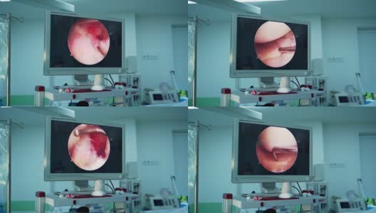 外科医生团队在医院手术室进行手术高清在线视频素材下载
